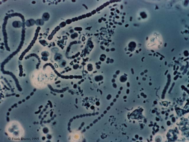 Sample of methanogens. Credit: Frank Dazzo.